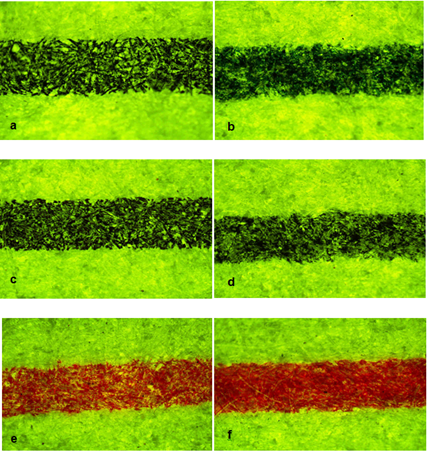 Figure 5: Different intensity of fluorescence observed in the samples kept in normal room condition for 30 days a) Cello finegrip blue ball b) Add achiever blue gel c) Claro Champ black ball d) Pilot luxor V7 black gel e) Cello butterflow red ball f) Uniball signo gel.