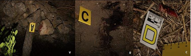Figure 1: Photographic Evidence of the Judicial Inspection of the Crime Scene. A: Stone of Considerable Mass and Weight, Soaked in Blood, Placed on a Wall a Few Meters from the Property. B: Blood Pool Located Between the Stone and the Property. C: Dental Element Soaked in Blood Located Near the Blood Pool, which Belonged to F.