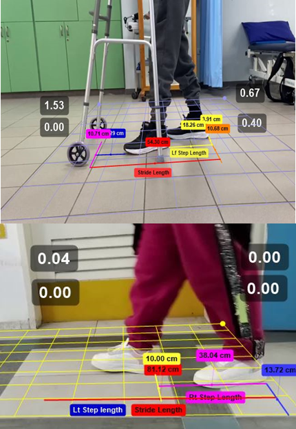 Figure 1: Patients gait parameters on Kenova capture system.