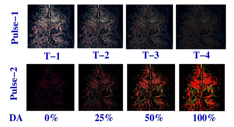 Figure 4: The consumption rate of the drug can be estimated from the ratio of image intensity to the time interval, which can be computed using Artificial Intelligence. In the same way, pulse-2 images could estimate the utilization rate of drug activity. If both the rates are the same, it may be concluded that 100% of the drug is utilized for treatment purposes. Change of utilization rate with time is equivalent to the growth rate of the tumor or the spreading rate of cancer.