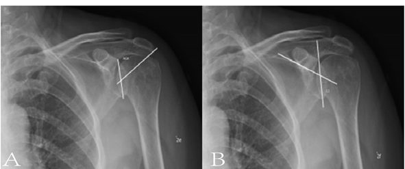 Figure 4: AGA, GI (A, B).