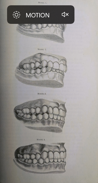 Figure 10: Chupein TF appliance design.