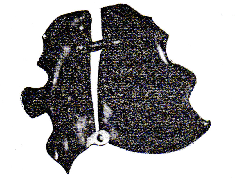 Figure 15: Jackson VH 3 looped M midline spring.