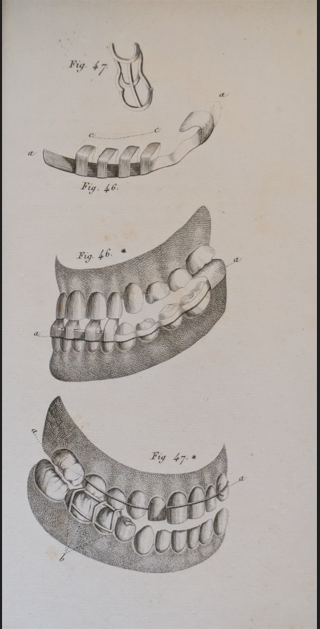 Figure 2: Catalan appliance after Schange JMA.