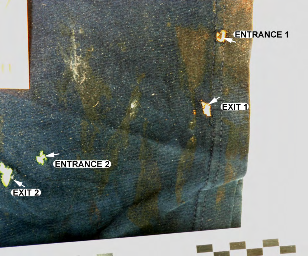 Figure 9: Robert Light’s left anterior t-shirt sleeve shows four bullet holes; entrance 1 was the first strike by the bullet through Light’s proximal forearm. The hole below was from the bullet exit. The other two holes to the left of the shirt in the image correspond to bullet entrance 2 and exit 2 which were consistent with the path of the bullet through his arm, where it entered the upper left arm and exited prior to entering the left anterior axilla and through Light’s thorax (Figure 8).
