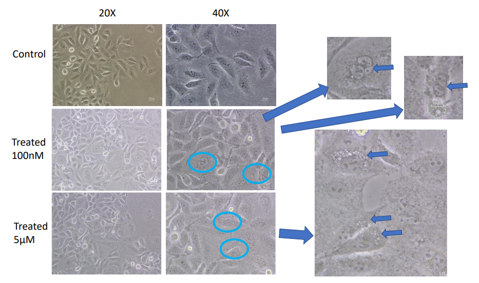Figure 3: Development of MCF-7 resistance cells by treatment with Cisplatin drug.