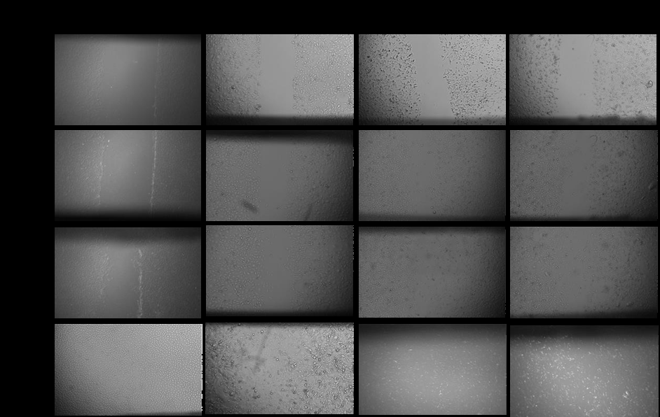 Figure 6: Cell migration assay for MCF-10A (Control), MCF-7 treated with Cisplatin at 5µM, MDA MB231 cells with no treatment, and MDA MB 231 treated with cisplatin drug at 100µM.