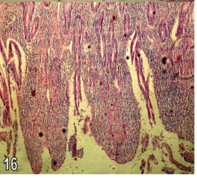 Figure 15: Section in the caecum from group (4) chicks showing severe invasion of the mucosa by schizonts with marked fibrosis of the intestinal wall associated with regeneration of surface epithelium (H&E X100).