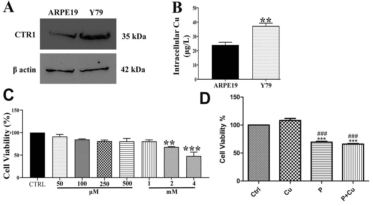 Figure 1: CTR1 expression, Intracellular copper concentration and Cytotoxicity: (A) CTR1 expression in Y79 compared to ARPE19 cells; (B) Intracellular copper concentration in Y79 compared to ARPE-19 cells using AAS; (C) Cell viability was measured at varying concentrations of penicillamine in Y79 cells at 24 h; (D) Cell viability on penicillamine co-treatment with Cu in Y79 cells; ** p < 0.01; *** p < 0.001; when compared to control. # p < 0.05; when compared Cu.
