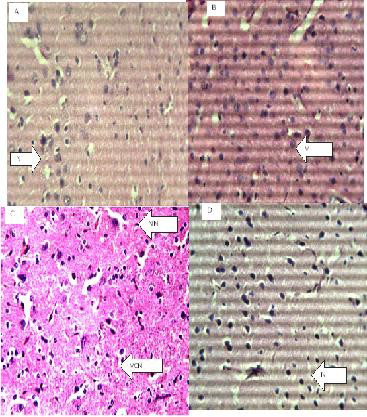 Figure 4: Figure of the Brain (Hematoxylin and eosin. H and E ×100).
