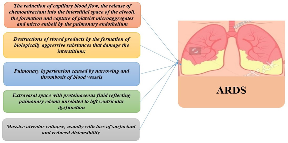 Figure 1: Causes of ARDS development.