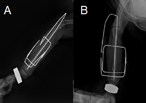 Figure 3: Postoperative image of the tibiotarsus region of a A. aestiva. A. Final appearance following Tie-in implementation in the right tibiotarsus. B. Patient 24 hours post-surgery, showing limb movement and early functional use with mild weight-bearing. (Source: Hospital Veterinário Pet Fauna).