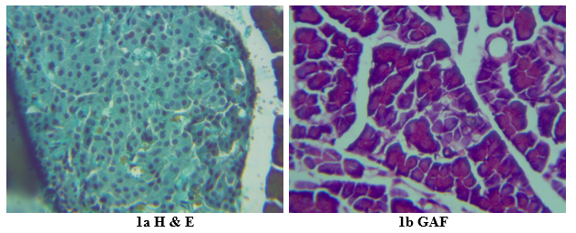 Figure 1: ### Gomori Aldehyde Fuschin Stain