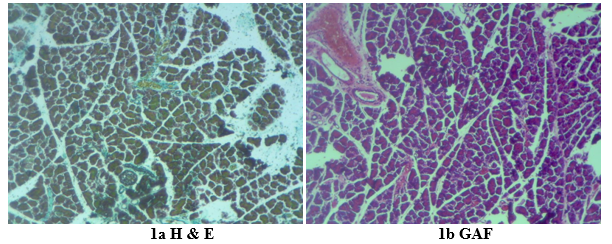 Figure 2: Photomicrographs (x 400) of pancreas of diabetic rats given placebo treatment. (H&E= Haematoxylin and eosin, GAF=Gomori Aldehyde Fuschin stain)