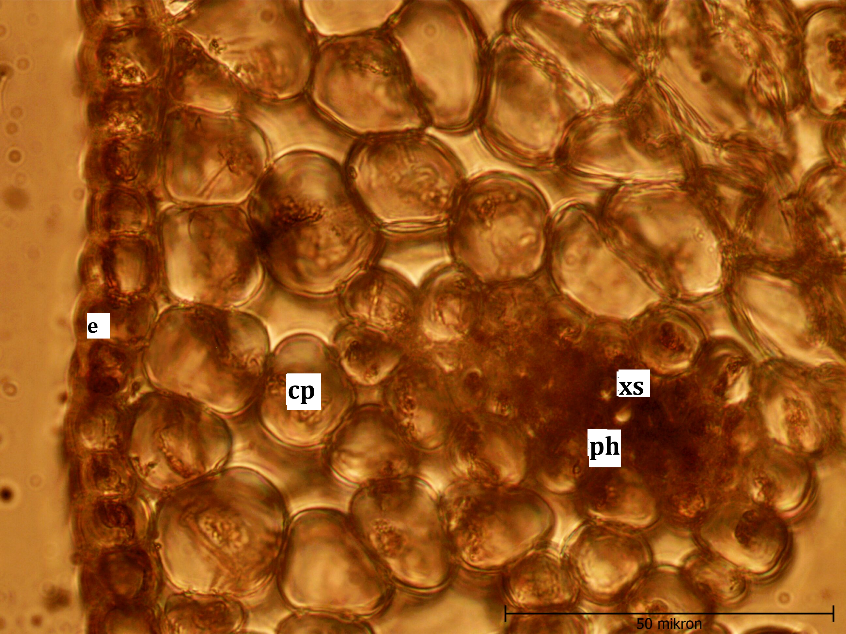 Figure 3: Colchicum kotschyi Stem cross-section (x40), e: epidermis, ph: phloem, cp: cortex parenchyma, xs: xylem, scl: sclerencima.
