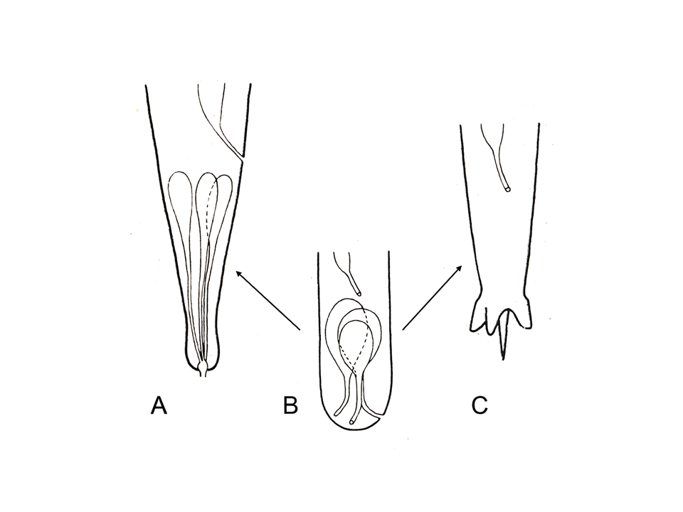 Figure 5: A) Three caudal glands with one terminal opening and spinneret; B) three separate outlets (exemplified by Diplopeltis incisus); C) three-pointed tail in a Secernentea lacking caudal glands (exemplified by Molinostrongylus). Sketches by Osche [107], newly arranged.