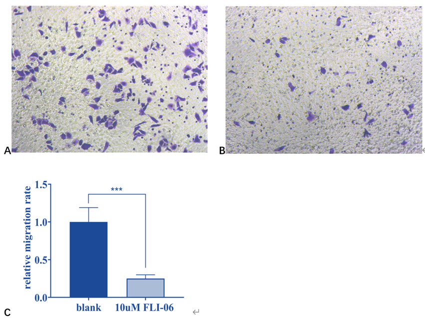 Figure 1: Number of AM cells invasion after FLI-06 treatment. (A) Number of AM cells invasion in control group. (B) Number of AM cells invasion in the FLI-06 treatment group. (C) AM cells invasion number comparison.