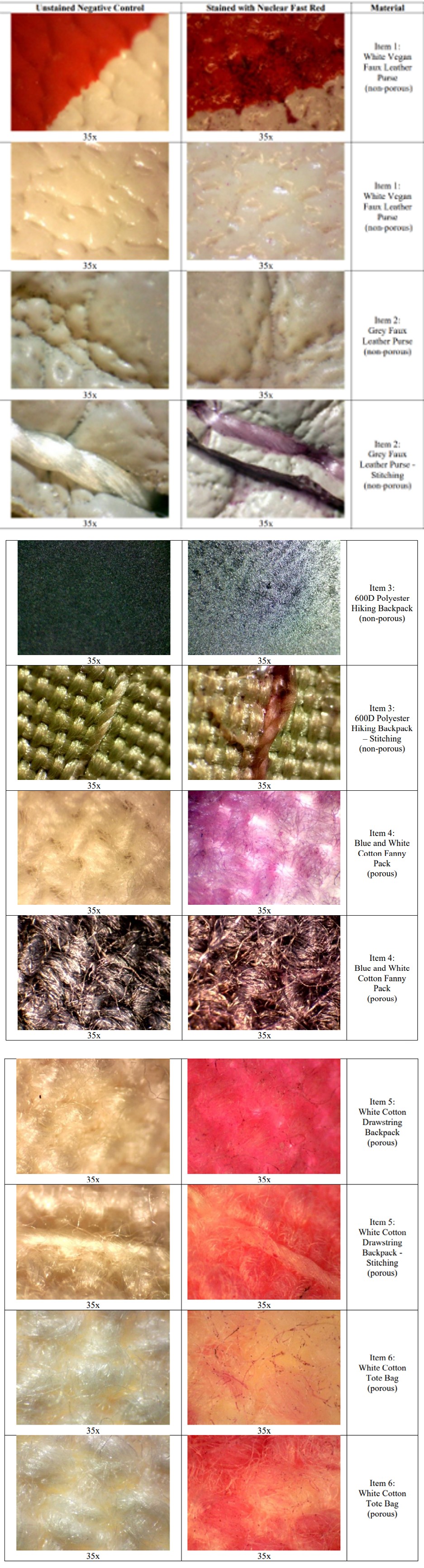 Figure 2: Comparison of Negative Controls with Positive Stained Substrates for NFR Imaged Under the Stereomicroscope. The Images Included are Representative of the Type of Results Observed. Magnification Of 35x.