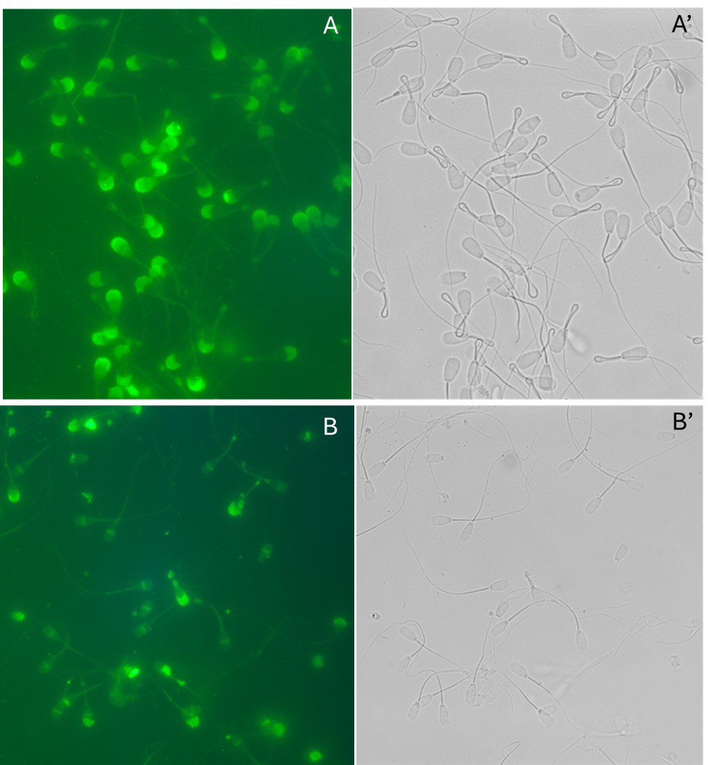 Figure 5: Matched phase contrast (A’ & B’) and fluorescence (A & B) images of acrosome-intact (Figure A & A’) and acrosome- reacted sperm induced by LPC (Figure B & B’) & stained with FITC-conjugated PSA (Pisum Sativum agglutin).