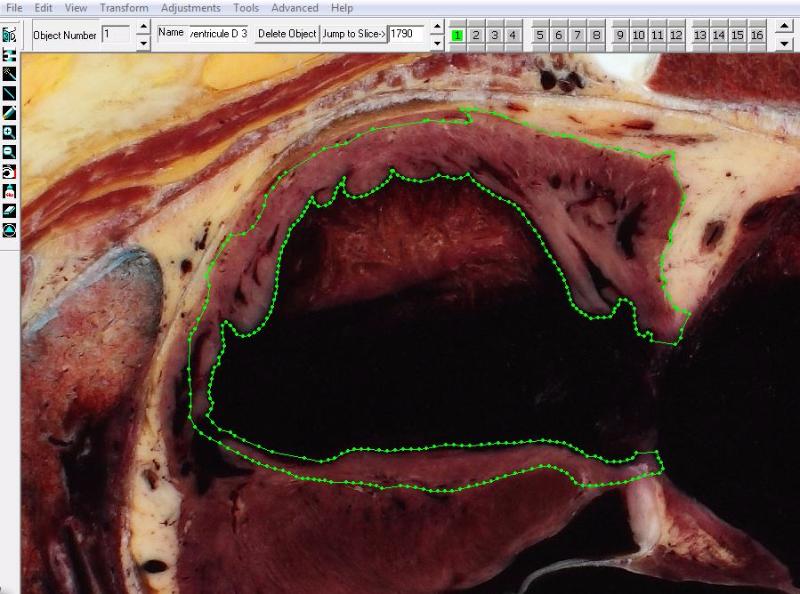 Figure 1: Interface screen of the Winsurf® software (version 3.5) for drawing the boundaries of the right ventricle (green line and points) on the anatomical slice number 1790. This is done with the pen tool by using the green channel.