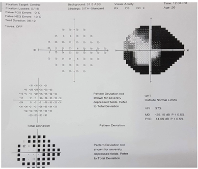Figure 3: Concentric visual field defect (left eye).