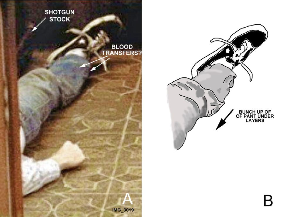Figure 9: A. Cobain’s right leg, partial right arm, and hand; there appear to be transfer bloodstains on the lower leg pant (arrows), but these are not clearly discernible due to low image resolution. No other bloodstains were obvious on the thigh pant, long sleeve shirt, and hand. The shotgun stock is partially shown. Image cropped from image. B. Drawing from A by author BB that graphically shows the bunching up on Cobain’s thigh three layers of clothing that were under his blue jeans.