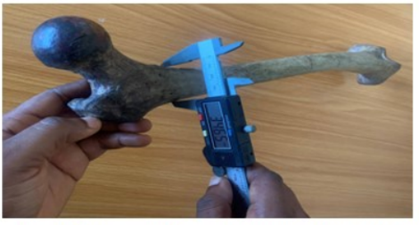 Figure 3: Measurement of proximal transverse diameter of femur.