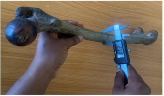 Figure 6: Measurement of middle sagittal diameter of femur.