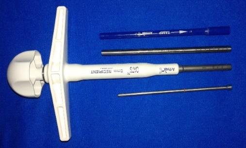 Figure 5: Osteochondral graft.