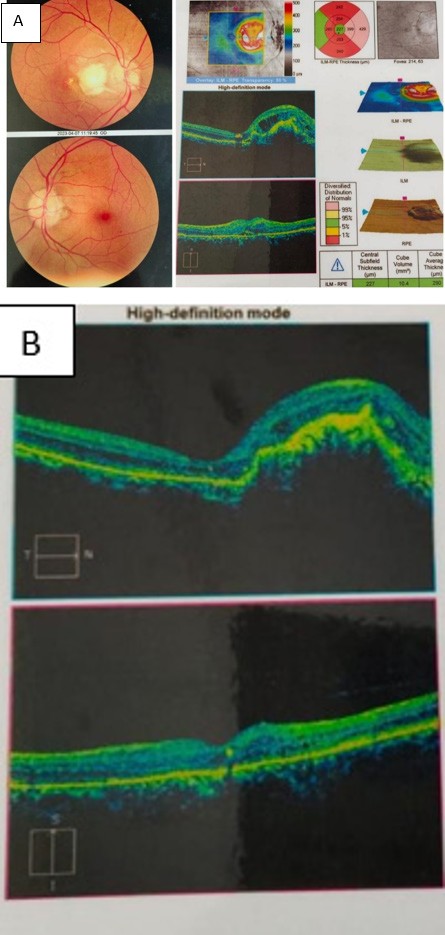 Figure 4