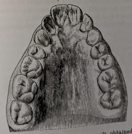 Figure 17