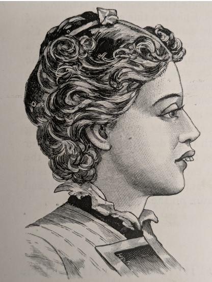 Figure 4: Etchings of profile before treatment.