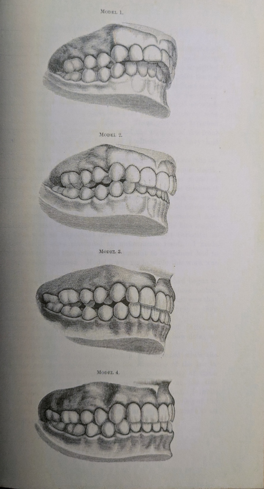 Figure 5: Etchings of profile after treatment.