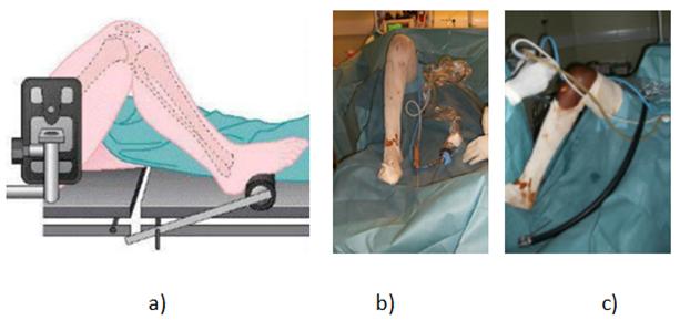 Figure 1: (a) Installation, (b) photo CHOM et abord (c) en triangulation CHOM