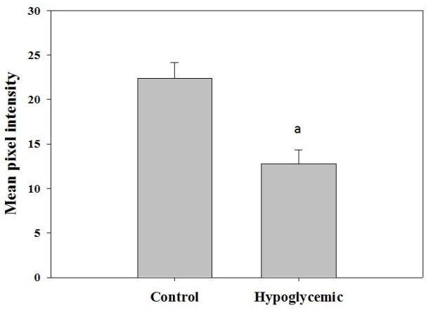 Figure 4: Real Time PCR analysis of Creb and BDNF mRNA expression in the cerebral cortex of experimental rats. Values are mean ± S.E.M. of 4–6 separate experiments. Each group consists of 4–6 rats. a p<0.001 when compared to control.