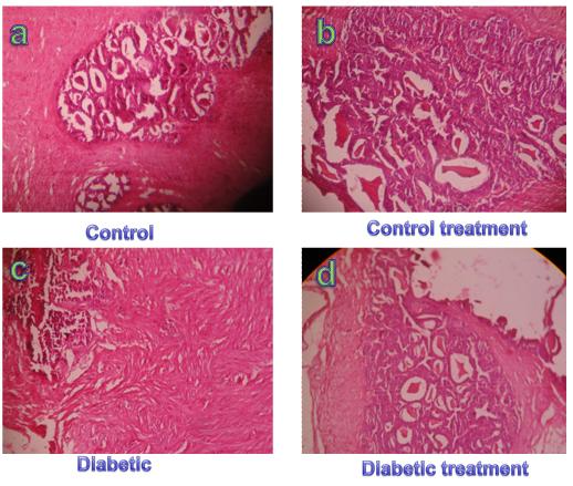 Figure 1: Histology of pancreas tissue of control (Figure c), control treatment (Figure c), Diabetic rat’s tissue (Figure c) showed extensive damage to the pancreatic beta islets of Langerhans and reduced the dimensions of pancreatic beta islets cells. When the diabetic rats were received aqueous suspension of Ocimum sanctum for two weeks and its showed regenerating tiny islets (Figure d) as compared with diabetic group.