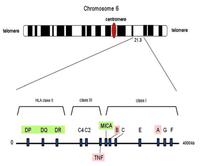 Figure 1: Chromosomal mapping of 6p21.3, which contains the Major Histocompatibility Complex (MHC) region. The MHC region spans a 4000-kb segment and consists of the human leukocyte antigen (HLA) class II, III, and I regions, extending from the centromere to telomere. In addition more than 80 non-HLA genes are expressed in the MHC region examples complement 2 (C2), complement 4 (C4), MHC class I chain-related gene A (MICA) and tumor necrosis factor (TNF). HLA: HLA-B*51: HLA-B*51 is one of the split antigens of HLA- B*5. At the present time, 106 amino acids sequence variants for HLAB*51 are known, coded by 132 different alleles, five of which are nulls. Among the HLA-B*51 alleles, HLA-B*51:01 is the most common. The distribution of HLA-B*51 alleles is not different between BD patients and controls, no disease-specific polymorphisms have been found, no exonic sequence difference has yet been found between patients and controls, and intronic/promoter sequence variations were not found to be disease-specific. Therefore, it seems that there are no disease-specific polymorphisms and that HLA-B*51 itself is a risk gene [14]. In 1973 Ono and his colleagues reported a strong association between BD and HLA-B*5 in a Japanese population, the association between BD and HLA-B*51 has been repeatedly demonstrated across different ethnic groups, [10]. The strongest association between HLA-B*51 and BD, confirmed in two Genome-wide association studies (GWAS), indicating that HLA-B*51 plays a primary role in the development of BD [15]. However, HLA-B*51 has been identified as the genetic marker most strongly associated with BD, it has also been reported that the highest contribution made by the HLA-B locus to overall genetic susceptibility of BD is 19%. This is why other susceptibility genes have been extensively investigated [16]. There are limited evidences for the biological role of HLA-B*51 in the pathogenesis of BD, and several hypotheses have been proposed. The most obvious way to demonstrate the biological function of a given gene would be to build a transgenic (Tg) or knock- out mouse system. Generated HLA-B*51 Tg mice, but these mice failed to develop any BD-related manifestations and only showed neutrophil hyperactivity towards f-Met-Leu-Phe (bacterial chemotactic peptide) as compared with control Tg or non-Tg mice [17]. In humans, a significant correlation was observed between neutrophil hyper function and HLA-B*51 positivity, regardless of the presence of BD. Thus, it appears that HLA-B*51 might be responsible, at least in part, for neutrophil hyperactivity in BD, and the possession of HLA-B*51 is not sufficient to induce clinical disease, and additional genetic or environmental factors are required to trigger disease development [13]. **HLA-A region:** Although many studies have investigated the HLA class I region in BD patients, only a minority of studies have reported significant results for the HLA-A gene. While HLA-A*26 has been reported to be associated with BD in Taiwan and in Greece, no significant associations have been found in studies conducted in Palestine, Jordan, Iran, Ireland, Italy, or Turkey [18,19]. However, it was clearly demonstrated that HLA-A*26 is a primary susceptibility gene of BD in the Japanese GWAS [20]. An independent association between BD and the HLA-A locus has also been reported in Turkish and Korean studies .Unlike HLA-B*51, HLA-A*26:01 was found to be associated with a poor prognosis for BD- related uveitis in the Japanese study [21]. **Non-HLA genes within the MHC region:** Although a strong association between BD and HLA-B*51 has long been known, a putative susceptibility gene near HLA-B*51 was extensively sought because of limited evidence of a direct relation between HLA-B*51 and the pathogenesis of BD. In this respect, tumor necrosis factor (TNF) and MICA have been investigated as strong candidate genes [13]. **TNF (Tumor Necrosis Factor) gene:** TNF is a multifunctional cytokine plays a central role in the initiation and regulation of the immune response. TNF gene is situated in the class III region between HLA-B and HLA-D, the contribution of TNF gene polymorphisms to BD has been an interesting research topic. Of the TNF related polymorphisms, those in the TNF-α promoter gene at positions -238, -308, -857, -863, and -1031 have been studied in various ethnic groups, the polymorphisms at positions -238A, -857T, and -1031C are significantly associated with BD, those at -238A and -1031C increase the risk of BD whereas the one at -857T decreases the risk of BD [22,23]. **MICA gene:** MHC class I chain-related (MIC-A and MIC-B) genes encode proteins which show homology with classical HLA molecules, but they are not expressed on normal circulating lymphocytes. MIC proteins are expressed on the surface of various cells (gastric epithelium, endothelial cells and fibroblasts) and are ligands for NKG2D; an activating natural killer-cell receptor also found on γδ T cells and αβ CD8 T cells [24]. Because this gene is highly polymorphic and its amino acid sequence shows a similarity with the MHC class I chain, it was once thought that MICA might play a specialized role in antigen presentation or T cell recognition [25]. The MICA gene was proposed as a BD candidate gene who found that MICA-A6 allele is strongly associated with BD. Moreover, a fine mapping study using highly polymorphic microsatellite markers showed that the critical region for BD is the 46-kb segment between the MICA and HLA-B loci [18,25]. However, it was later found that the interaction between MICA molecules and γδ T cells is not restricted by the MICA gene polymorphism and does not require antigen presentation [26]. Despite the lack of a proven genetic association between MICA and BD, the autoreactive CD8+ T cell response to MICA peptide was found to be more frequent in BD patients than in healthy controls, and all responders had HLA- B*51 and active disease state. This finding might suggest that MICA, although not associated with BD at the genetic level, may be involved in the pathogenesis of BD as an effector protein [27]. The regions on chromosome 6 flanking the HLA-B*51 locus including TNF gene and MICA gene, have been studied extensively since TNF exerts a profound effect on the immune response, and MICA has a possible role in non-classical antigen presentation at mucosal surfaces [28]. However, it is becoming apparent that polymorphic areas in these regions, are actually a consequence of linkage disequilibrium with HLA-B*51, and may have little independent contribution to disease in HLA-B*51