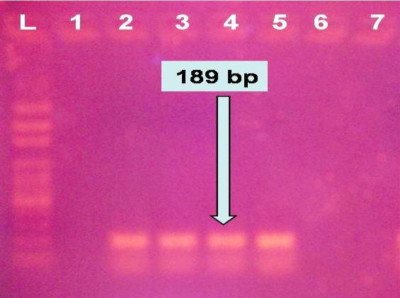 Figure 4: The RT-PCR run showing the four H5N1 positive crayfish samples documented by appearance of 189 bp band on the ethidium bromide stained gel electrophoresis.