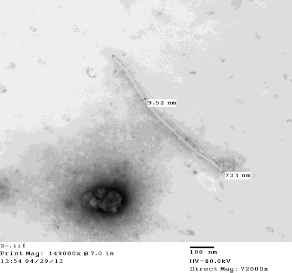 Figure 1: Electron micrograph: showing single flexible filamentous particle of (PVY) under electron microscope in Burna potato variety sap. 149,000 X enlargement and viral particles were (723nm) in length and (9.25) in width.