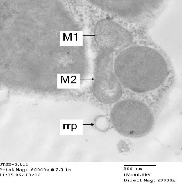 Figure 2: Ultra-thin cross section of electron micrograph: showing the effect of PVY on the cell organelles in infected leaf of Datura metel L. indicated that the mitochondria (M1) was damaged by viral infection . Note that the appearance of ruptures in the mitochondria membrane (M2) clearly demonstrates the lyses of its membrane in one side. However, (rrp) means appearance of ring-like profile was observed due to PVY infection.