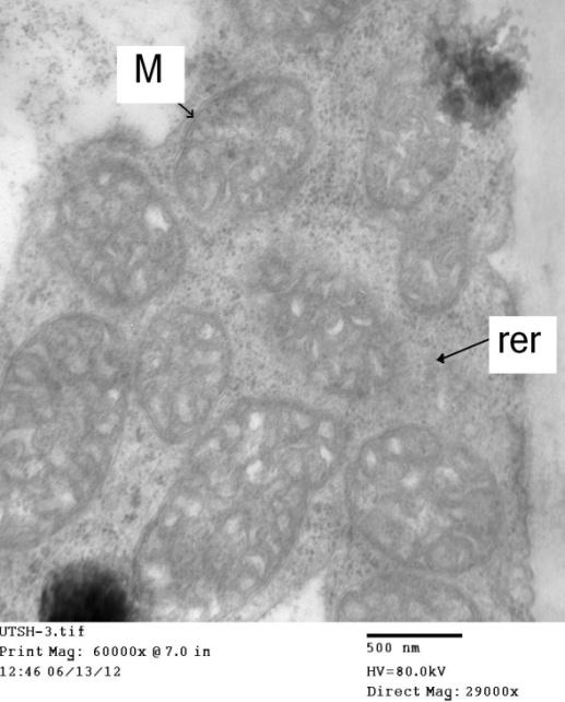 Figure 6: Electron micrograph of ultra-thin cross section in the healthy and asymptomatic leaf cell of Datura metel L. showing a lot of intact mitochondria (M) with duple membrane in the rough endoplasmic. Note the normal mitochondrion appearance.