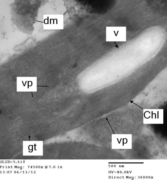 Figure 8: Electron micrograph of longitudinal ultra-thin section showing the effect of (PVY) on the cell organelles in infected leaf of Datura metel L. Note that the swelling of the chloroplast (Chl) and release of its matrix and forming visible vacuole-like structures (V) due to viral infection, .Note also that the appearance of filamentous virus particles (VP) of (PVY) in the iner matrix beside the grana and grana thylakoid (gt). However, viral particles had been shown also near the chloroplast in the cytoplasm. Note also that the viral infection caused mitochondria degeneration (dm) and also had damaged envelopes and lost cristae.