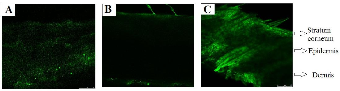 Figure 7: Confocal laser scanning micrographs of 6-coumarin-tagged transfersome vesicles (A), liposomes (B), and ethanolic PBS of raloxifene HCl (C). All the formulations were subjected to 8 hours of ex-vivo skin permeation study.