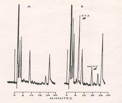 Figure 1: A chromatogram of pooled plasma either blank (A) or supplemented with 100 ng/ml hydrochlorothiazide (HCTZ) and 500 ng/ml chlorothiazide (CTZ).