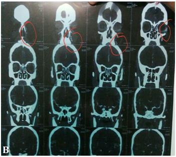 Figure 3: Computed Tomography (CT) angiography.