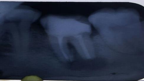 Figure 10: Follow-up visit: (1month).