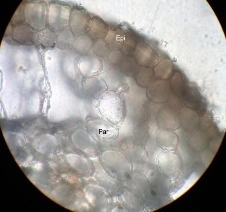 Figure 2: Transverse section of Root of Wedelia trilobata L. Ep: Epidermis; Par: Parenchyma cells; Ph: Phloem; Mx: Meta Xylem; PX: Proto Xylem and Xy: Xylem.