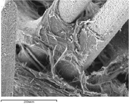 Figure 1: Connective-tissue cover on the implant surface in the defect periosteal zone 7 (A) and 14 (B, C) days after surgery. Scanning electron microscopy, magnification × 160.