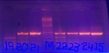 Figure 2: Electrophresis on 2% Agarose gel.