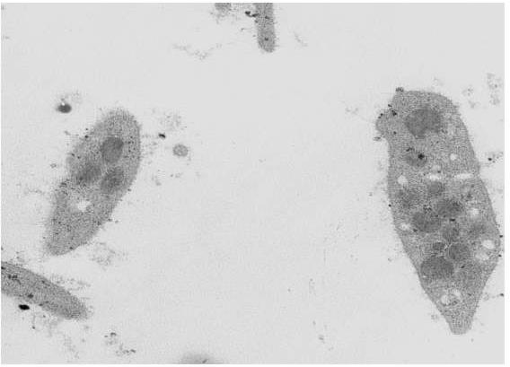 Figure 2: Normal granules and shape in platelets before immersion.